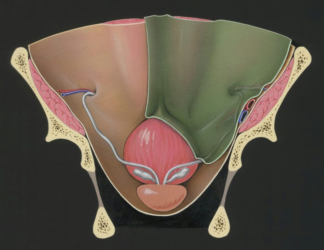 עיסוי ערמונית Prostate